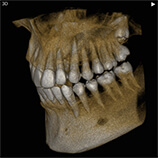 レントゲン写真